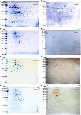 Identification of Novel Laminin- and Fibronectin-binding Proteins by Far-Western Blot: Capturing the Adhesins of Streptococcus suis Type 2